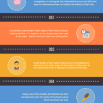 Hair Transplantation